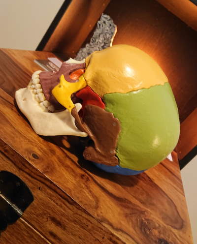 Schädel mit Pinolith im Hintergrund